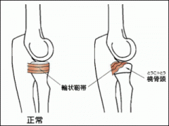 画像(240x180)・拡大画像(322x242)