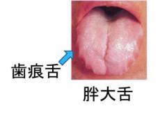 画像(240x163)・拡大画像(640x436)