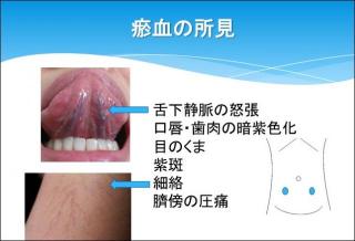 �摜(320x218)�E�g��摜(640x436)